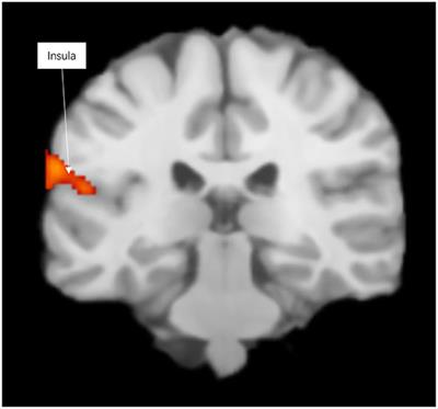 Separate Neural Systems Value Prosocial Behaviors and Reward: An ALE Meta-Analysis